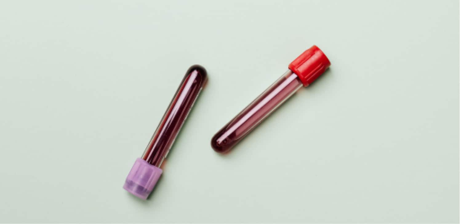 Everything You Need to Know About Platelet Rich Plasma