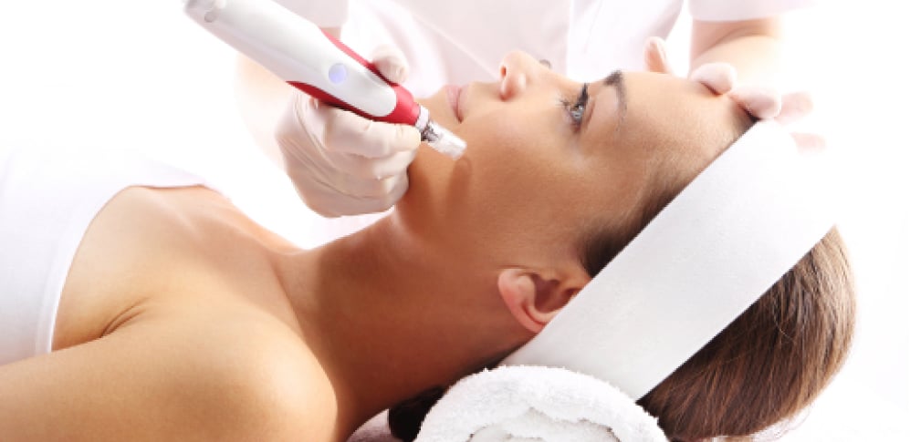 The Amazing Benefits of Microneedling