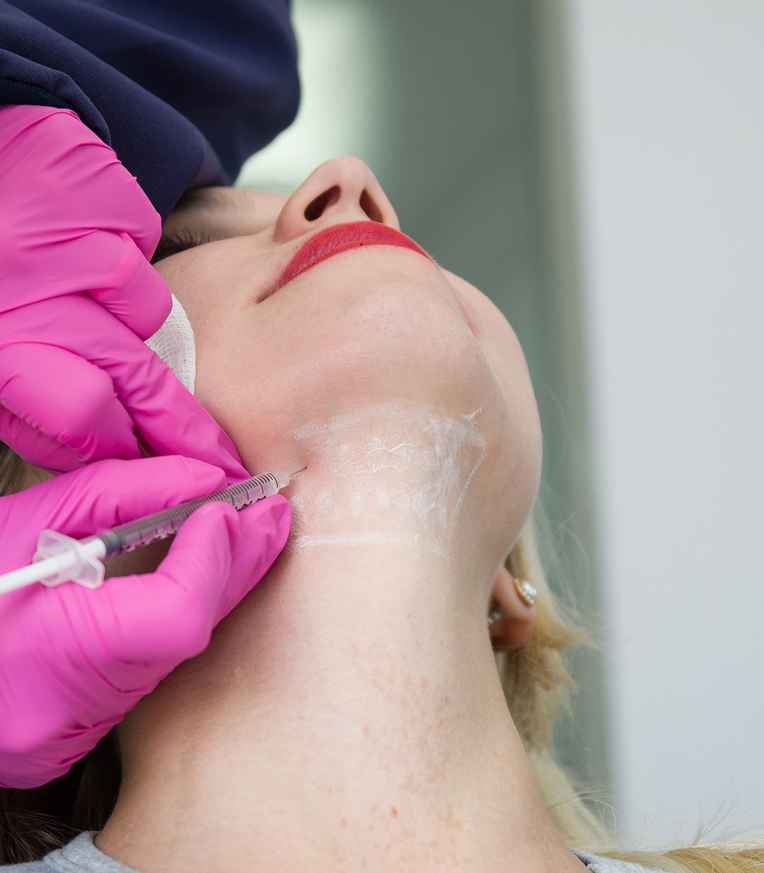 A close-up of a woman receiving a Kybella injection in the chin area by a professional wearing pink gloves, targeting submental fat for a more contoured jawline.