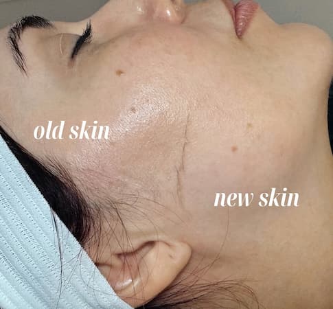 Old-Skin-New-Skin (1)