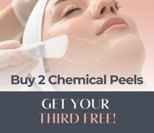 Buy 2 chemical peels, get your 3rd FREE