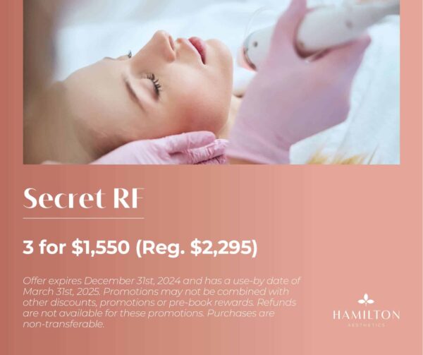 Secret RF - A Package of 3 for only 50 (Savings of 5)